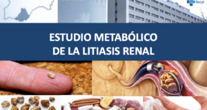 Estudio metabólico de la litiasis renal