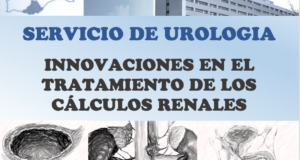 Innovaciones en el tratamiento de los cálculos renales