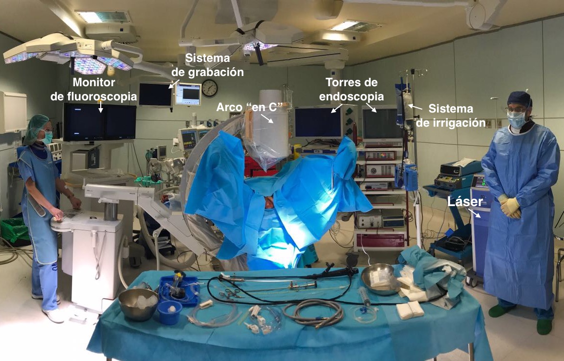 Ureterorrenoscopia flexible (RIRS)